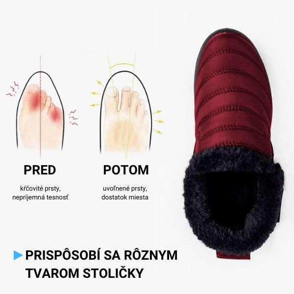 MAX™ - UNIVERZÁLNE TERMO TOPÁNKY